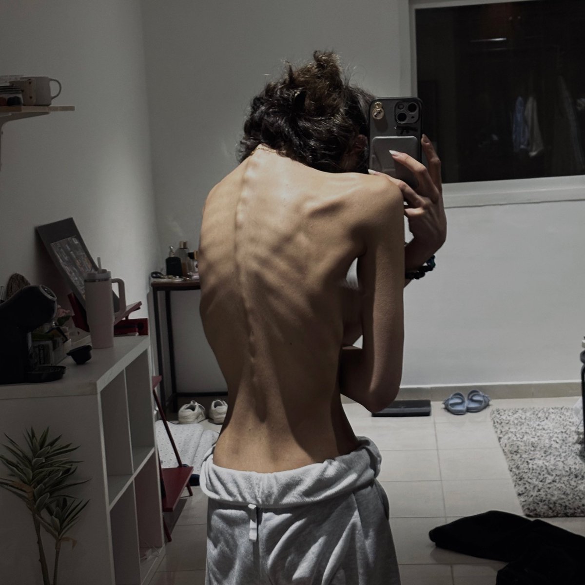 bmi ~ 13.4