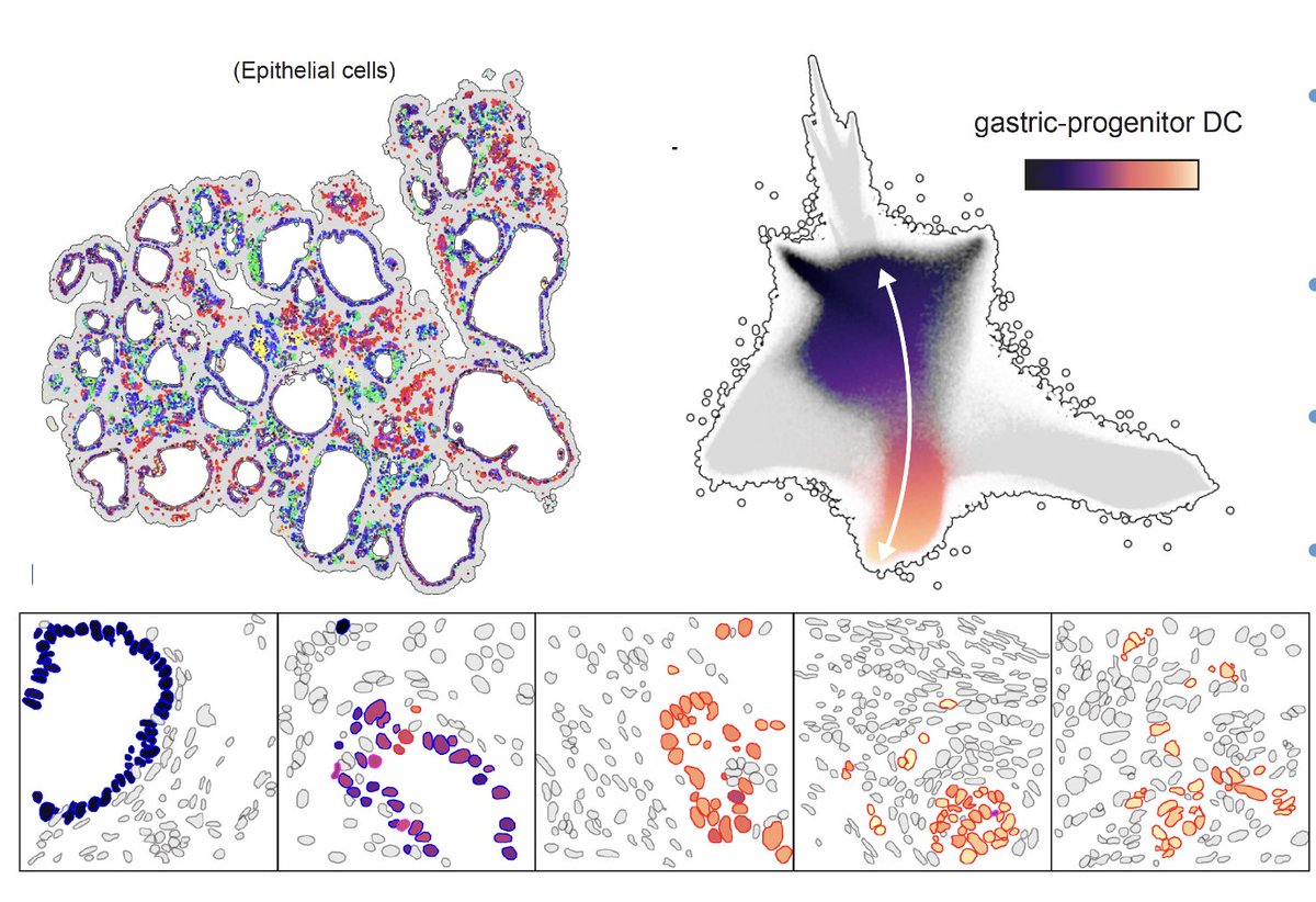 4) The gastric to progenitor axis is the strongest axis of variation among epithelial pre-malignant cells.  Thus we collected Xenium data to understand the tissue remodeling that occurs along this axis -&gt;