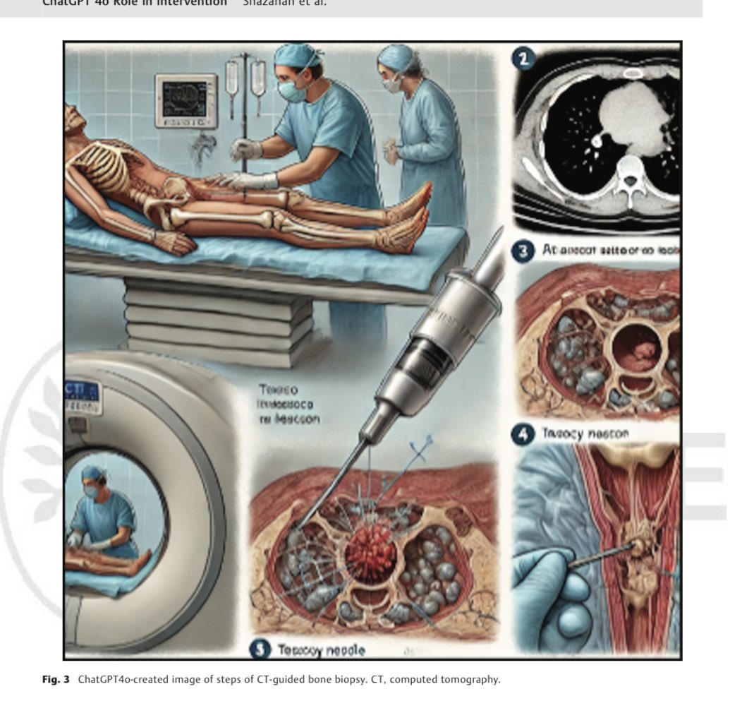 mskradiology4u (@mskradiology4u1) on Twitter photo Latest publication from ROH in colloboration with authors from other institutions <a href="/ROHNHSFT/">The Royal Orthopaedic Hospital</a> <a href="/ROHImaging/">ROHImaging</a> <a href="/BSSR_Site/">BSSR</a> <a href="/ESSRmsk/">European Society of Musculoskeletal Radiology</a> <a href="/intskeletal/">International Skeletal Society | ISS</a> <a href="/MSKSocietyIndia/">MSS India</a> <a href="/Heath_Lodge/">Heath Lodge Clinic</a> Latest publication from ROH in colloboration with authors from other institutions <a href="/ROHNHSFT/">The Royal Orthopaedic Hospital</a> <a href="/ROHImaging/">ROHImaging</a> <a href="/BSSR_Site/">BSSR</a> <a href="/ESSRmsk/">European Society of Musculoskeletal Radiology</a> <a href="/intskeletal/">International Skeletal Society | ISS</a> <a href="/MSKSocietyIndia/">MSS India</a> <a href="/Heath_Lodge/">Heath Lodge Clinic</a>