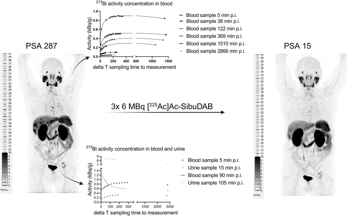 JournalofNucMed's tweet image. Efficacy, safety, blood kinetics, and ²¹³Bi distribution studies of ²²⁵Ac-SibuDAB in prostate cancer patients: ow.ly/LxG950W9YGM

#NuclearMedicine #RPTherapy #ProstateCancer