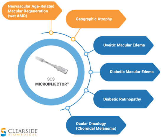 clearsidebio's tweet photo. Together with our partners, #ClearsideBio is seeking new treatments for multiple blinding #eyediseases affecting millions of people worldwide. Learn more: https://t.co/MpviyeELzc
#OpthoTwitter $CLSD #ophthalmology #retinaldisease https://t.co/WVniuYSykG