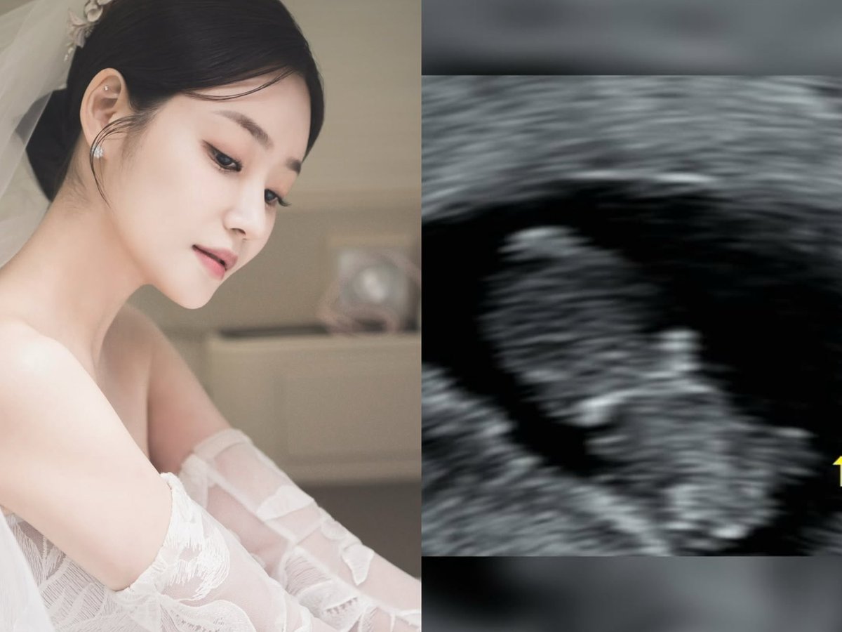 "ยูนา"AOA แจ้งข่าวดีว่าตอนนี้กำลังตั้งครรภ์ลูกน้อยอยู่👶🏻 ยินดีด้วยนะคะ