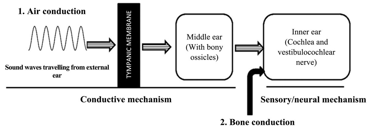 Advances in Physiology Education (@advphysioleduc) on Twitter photo Teaching Innovations by <a href="/RAJUPHYSIOLOGY/">Dr RAJU S KUMAR💕🇮🇳</a> et al. Enhancing auditory physiology: simulating unilateral conduction defects to improve understanding of Rinne’s and Weber’s tests
🖱️ow.ly/oIPA50WhrF0 Teaching Innovations by <a href="/RAJUPHYSIOLOGY/">Dr RAJU S KUMAR💕🇮🇳</a> et al. Enhancing auditory physiology: simulating unilateral conduction defects to improve understanding of Rinne’s and Weber’s tests
🖱️ow.ly/oIPA50WhrF0