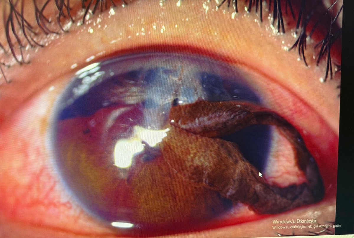 Gözünüze gözünüz gibi bakın