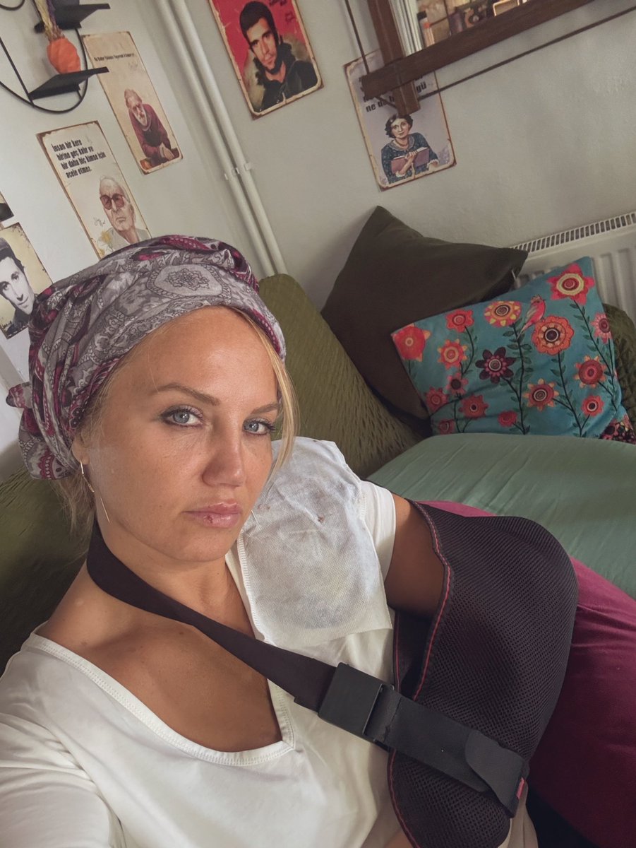 Sevgili dostlar sabah bir kaza geçirdim sol omuzumda iki kırık oluştu .
Omuz yeri alçı olmuyor o yüzden ,
bir süre dinlenmek zorundayım eğer geçmez, kaynama olmaz ise cerrahi müdahale yapılacak. 20 gün boyunca hiçbir aktivitede  yer almayacağım dostların bilgisine.