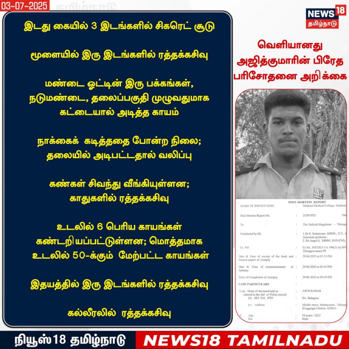 கொலை செய்த போலீஸ்காரர்களுக்கு மரண தண்டனை கொடுக்க வேண்டும்.

#JusticeForAjithKumar