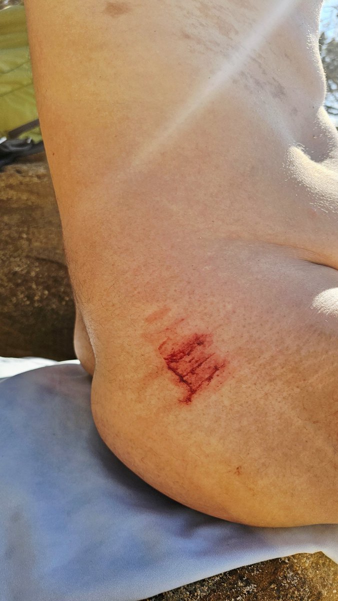 Ο μόνος που με έσκισε είναι ένας βράχος. Αλλά προμηνύει ότι θα συναντήσω κάποιον με το γράμμα Ε.