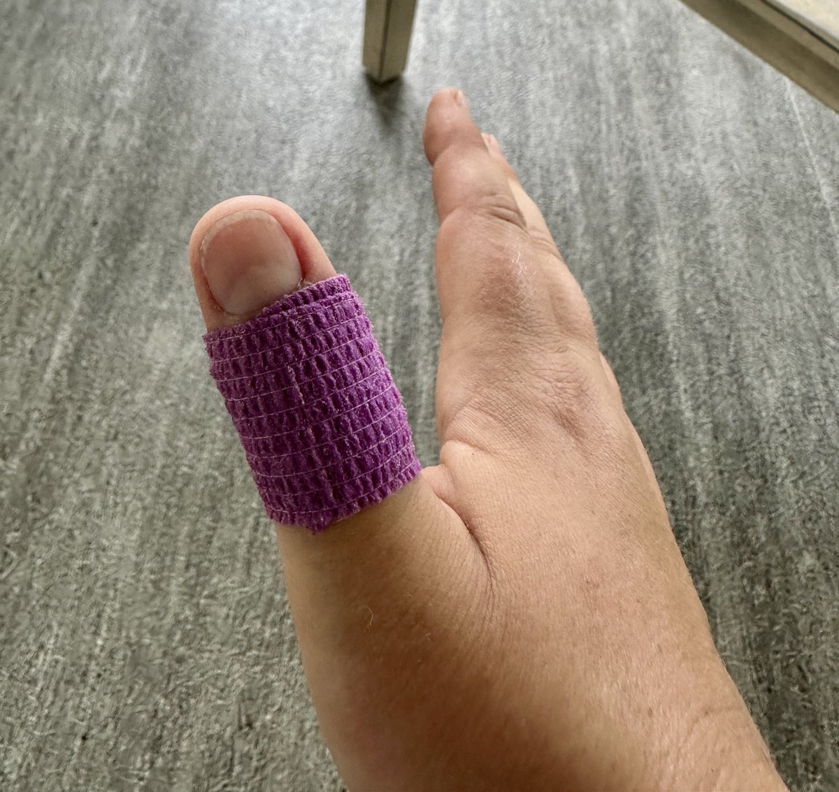 Pro tip: vet wrap makes an excellent blister cover.