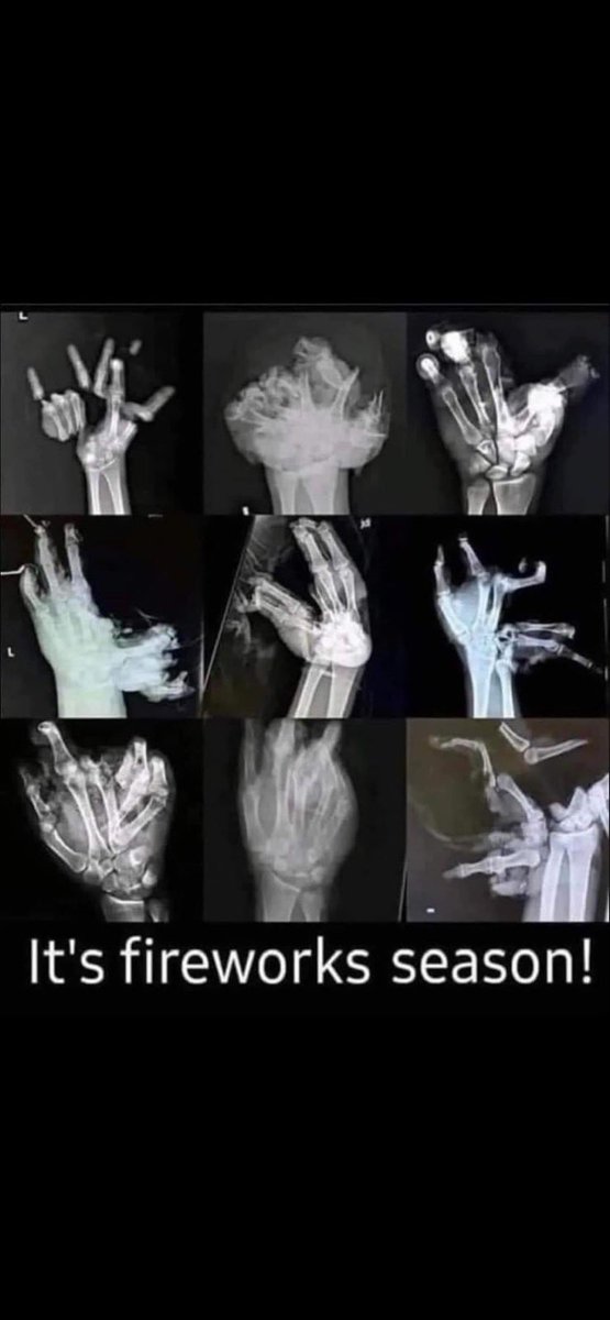 Cocoa_Schneider's tweet photo. Let’s all make good decisions this weekend!!!!!
🎆🎆🎆🎇🎇🎇🇺🇸🇺🇸🇺🇸🇺🇸🇺🇸🇺🇸🇺🇸
#CocoaFamily #TigerPride #4peat
#DontLetItHitDifferent 
@CocoaFootball https://t.co/NuJz02fkgQ