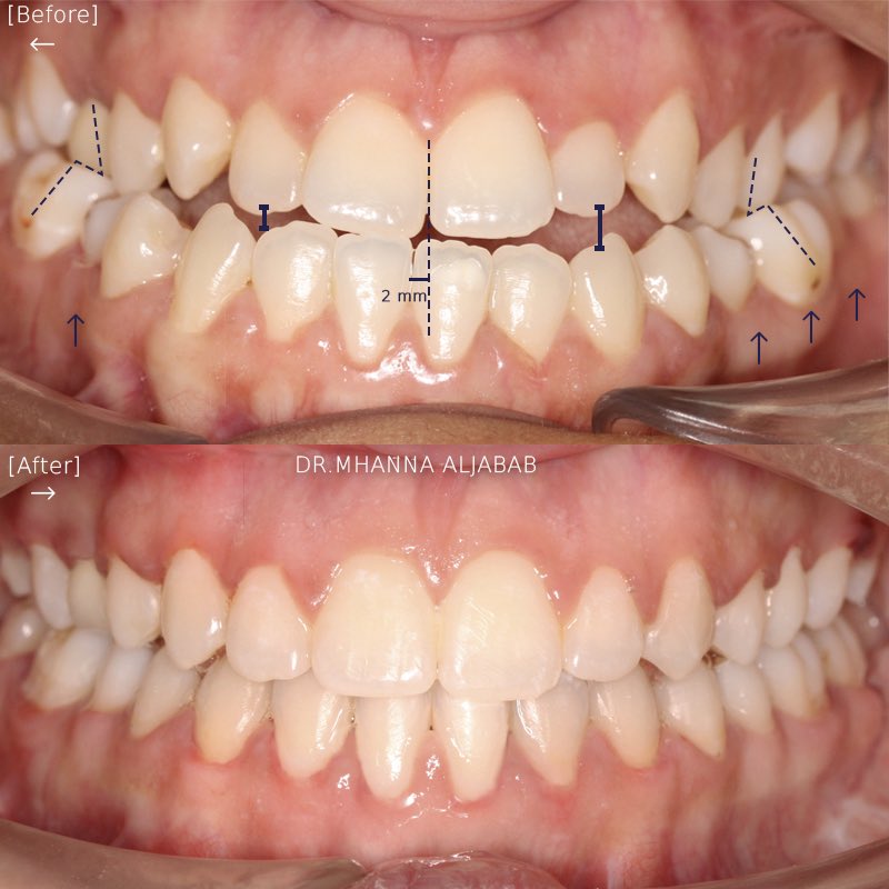 Dr.Mhanna Aljabab | د.مهنا الجباب tweet media
