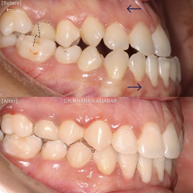 Dr.Mhanna Aljabab | د.مهنا الجباب tweet media