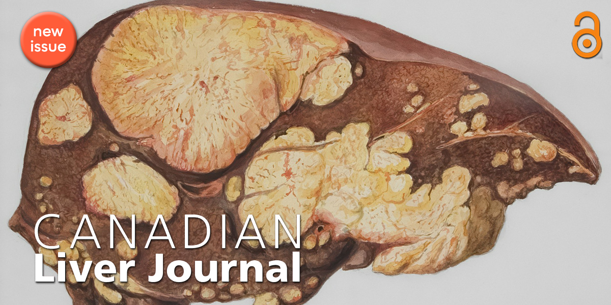 UTP Journals (@utpjournals) on Twitter photo Drug poisoning is a public health crisis, particularly among people living with #HIV and #HCV. In the new issue of CanLivJ, scholars from @McGillU ask whether identifying predictors of drug poisoning could help decrease drug-related deaths: bit.ly/CanLiv82j
<a href="/CASLupdates/">CASL</a> Drug poisoning is a public health crisis, particularly among people living with #HIV and #HCV. In the new issue of CanLivJ, scholars from @McGillU ask whether identifying predictors of drug poisoning could help decrease drug-related deaths: bit.ly/CanLiv82j
<a href="/CASLupdates/">CASL</a>