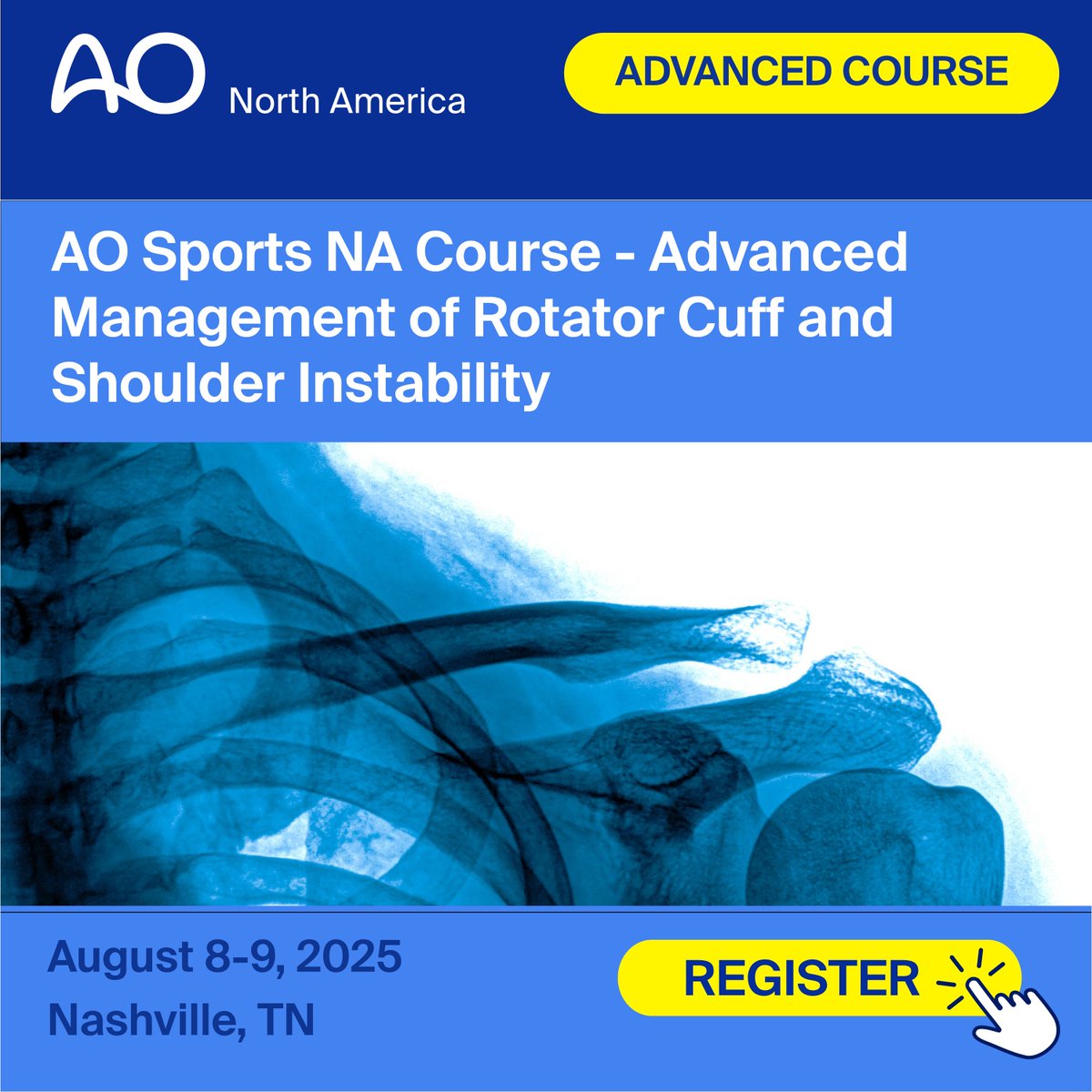 AO Sports NA Advanced Shoulder Management Course - Advanced Management of Rotator Cuff and Shoulder Instability

📅 August 8-10, 2025  
📍 Nashville, TN
👥Course Leaders: Drs. Keith Kenter &amp; Brent Ponce

Learn more: 🔗 bitly.aona.org/Sports-Advance…