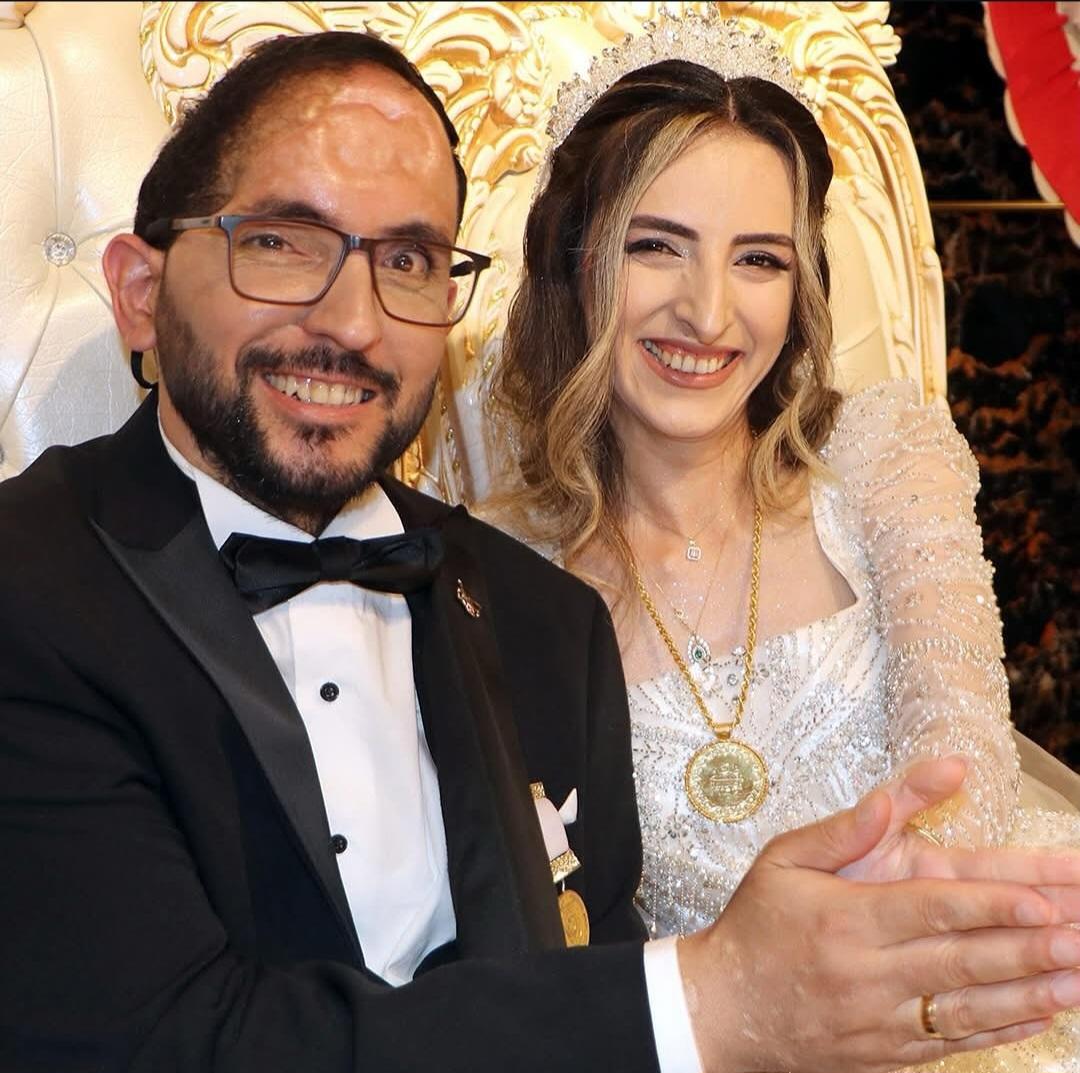 Alın size mutlu bir haber.

Şırnak'ta uzman çavuş olarak görev yaparken Gabar Dağı'nda el yapımı patlayıcının infilak etmesi sonucu ağır
yaralanıp Gazi olan Kıymetli kardeşim Ebubekir Durmuş (35), 14 yıldır sevdiği Sümeyra Payveren (30) ile evlendi.
Mutlulukları daim olsun.