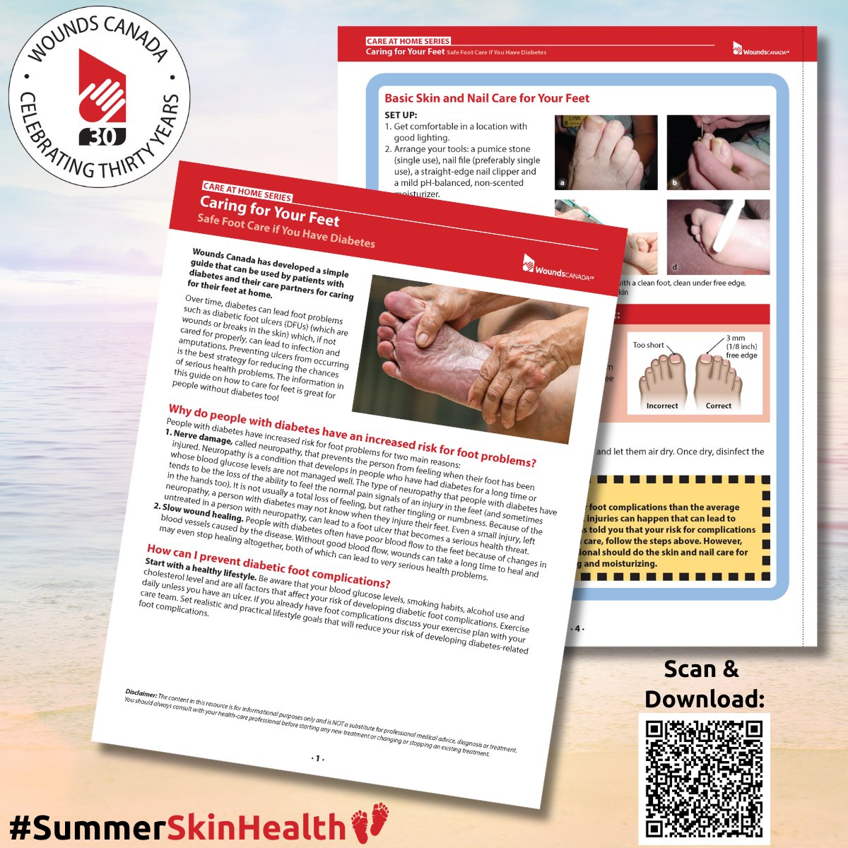 👣 Feet ready for summer? Don’t forget your daily foot check! Catching a blister or sore early can prevent serious complications. Check out this great resource on caring for your feet: ow.ly/iVwj50Wks66 

#WoundsCanada #WoundsCanada30 #SummerSkinHealth #PreventDontIgnore