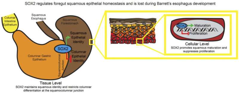 From the Labs at Baylor College of Medicine (@bcmfromthelabs) on Twitter photo How can #acidReflux & #BileRreflux lead to #BarrettsEsophagus? <a href="/millsjc67/">🔬🎸🚴♂️💻 🄼🄸🄻🄻🅂 🄻🄰🄱</a> <a href="/bcmhouston/">BCMHouston</a> and R Jin <a href="/WashU/">WashU</a> explain their findings. <a href="/jclinicalinvest/">Journal of Clinical Investigation</a> #SOX2 medicalxpress.com/news/2025-07-m… How can #acidReflux & #BileRreflux lead to #BarrettsEsophagus? <a href="/millsjc67/">🔬🎸🚴♂️💻 🄼🄸🄻🄻🅂 🄻🄰🄱</a> <a href="/bcmhouston/">BCMHouston</a> and R Jin <a href="/WashU/">WashU</a> explain their findings. <a href="/jclinicalinvest/">Journal of Clinical Investigation</a> #SOX2 medicalxpress.com/news/2025-07-m…