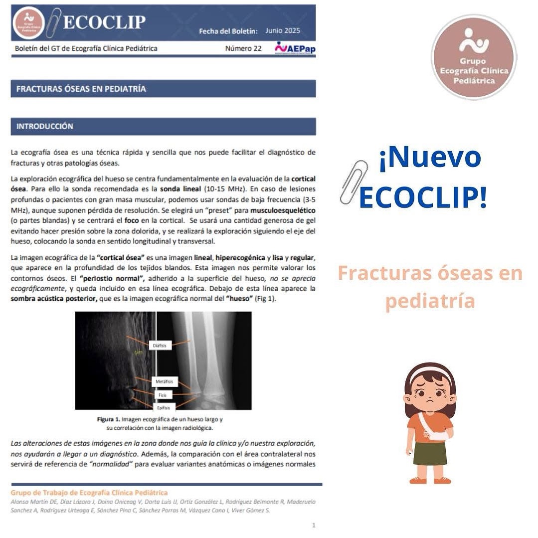 AEPap (@aepap) on Twitter photo 📎Nuevo ecoclip de nuestro <a href="/GTEcoPed/">GTEco Pediatrica</a> sobre la ecografía pediátrica como técnica rápida y sencilla para facilitar diagnóstico de fracturas y otras patologías óseas
#ecografifans
Ecoclip completo en:
aepap.org/wp-content/upl… 📎Nuevo ecoclip de nuestro <a href="/GTEcoPed/">GTEco Pediatrica</a> sobre la ecografía pediátrica como técnica rápida y sencilla para facilitar diagnóstico de fracturas y otras patologías óseas
#ecografifans
Ecoclip completo en:
aepap.org/wp-content/upl…
