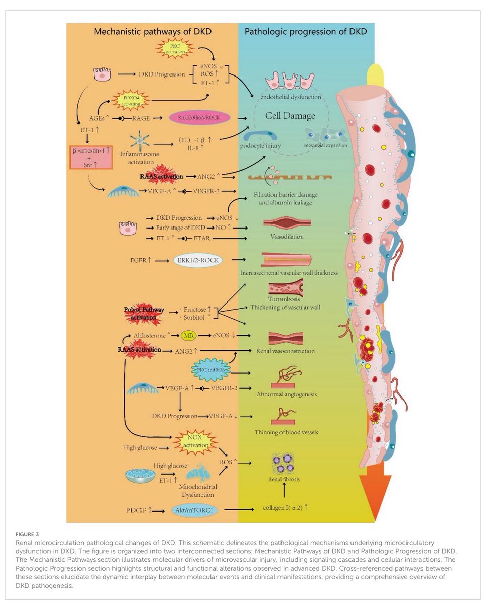 🤔Ever wondered how diabetes wrecks the kidney’s🫘 microvasculature?

This one image says it all: from AGEs 🔥 to RAAS 🧪 to fibrosis 🧱

👀 DKD = microcirculatory mayhem → glomerular doom 

📖 doi.org/10.3389/fendo.…

#NephTwitter #DKD #MedEd #Endocrine
