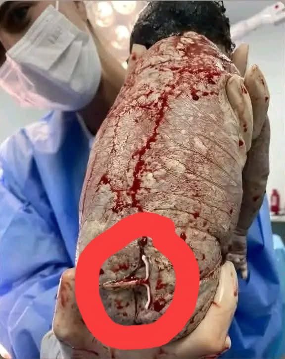 In rare cases IUD might fail and one conceives with it. And yes you can have a healthy baby with it. I’ve personally delivered a healghy baby with an IUD in situ. Although a pregnancy with an IUD has a higher risk of complications. 

Now I don’t want you to start thinking that