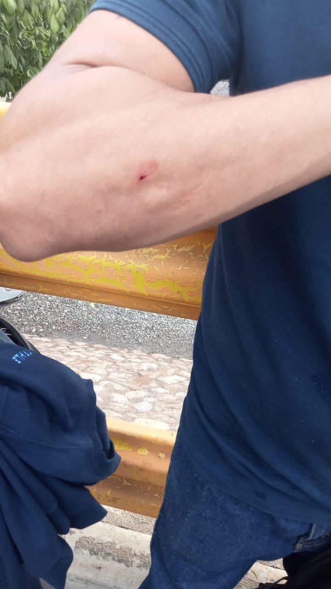 AlexIbaMen's tweet photo. 🚨 Circulan fotos de trabajadores lesionados en Mahle Saltillo.
Fueron agredidos por miembros de la #CTM en medio del proceso de votación para cambiar de sindicato. Denuncian violencia y represión por parte de quienes se niegan a perder el control.@marathb @STPS_mx https://t.co/yVymmlpc9R