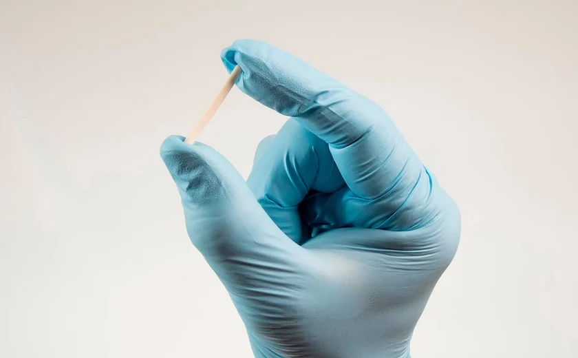 🚨 VIVA O SUS! Implante contraceptivo de alta eficácia que custa até 4 MIL REAIS e dura até TRÊS ANOS será incluído no SUS a partir do 2º semestre.