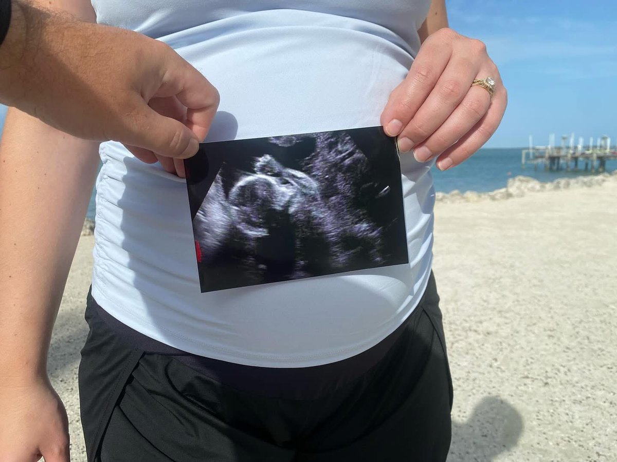 Connor DelPrete (@connor_delprete) on Twitter photo We bought a van, which can only mean one thing…
Baby Boy DelPrete coming October 2025!!! 💙💙💙
<a href="/caitlyn_penter/">Caitlyn Penter</a> We bought a van, which can only mean one thing…
Baby Boy DelPrete coming October 2025!!! 💙💙💙
<a href="/caitlyn_penter/">Caitlyn Penter</a>