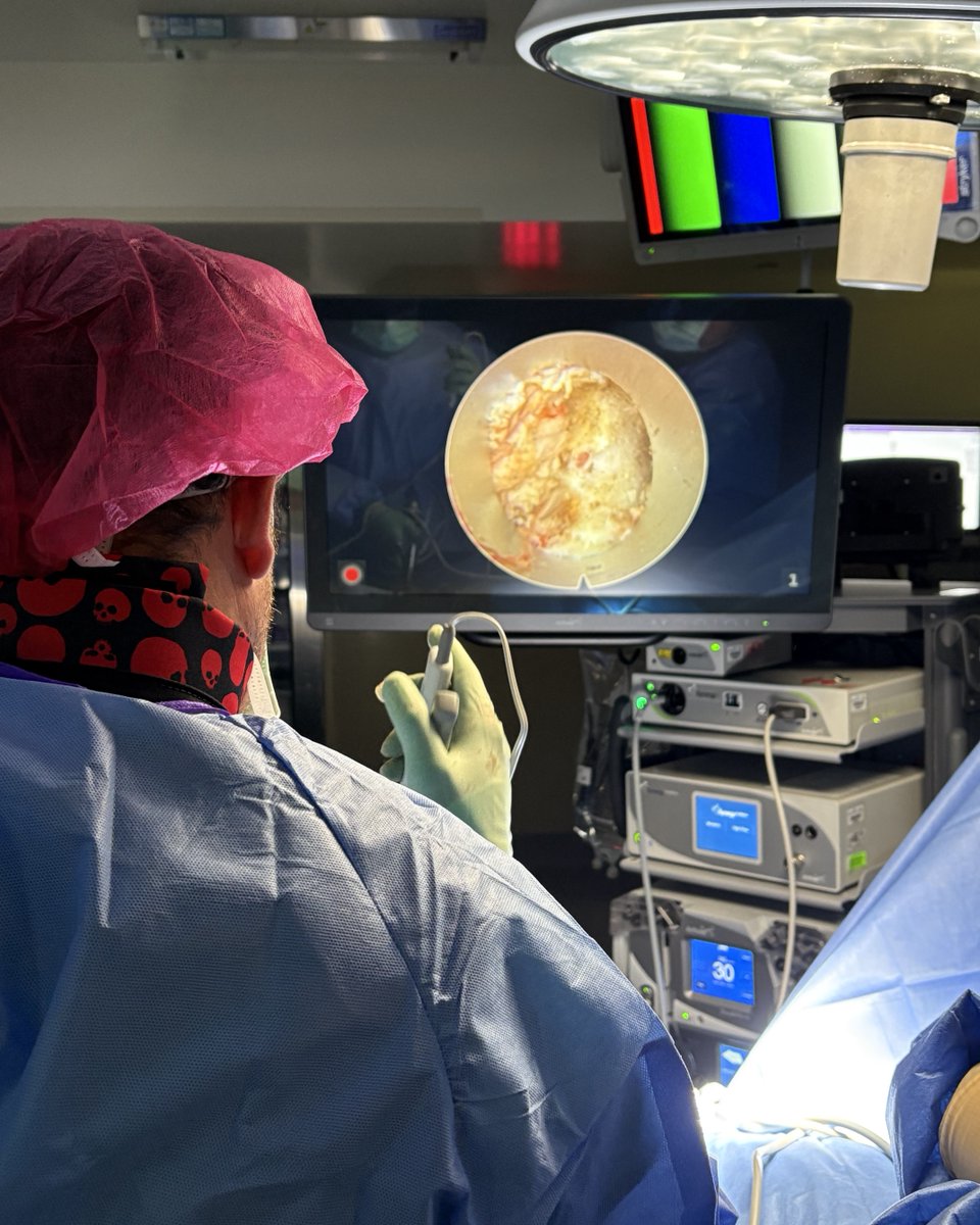 ArthrexSpine's tweet image. Congratulations, Gabriel Andres Flores-Milan, MD, Lakeland Regional Health, on recently completing his 15th ultra-minimally invasive endoscopic spine case using Arthrex innovation!
Dr. Flores-Milan began his journey into endoscopic spine surgery during his Skull Base Fellowship…