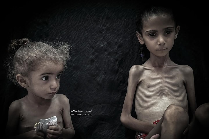 hamad_alnajjar's tweet photo. Gazze'deki çocukları unutmayın.

Çocukların çoğu, açlık ve abluka nedeniyle kilolarının yarısını kaybetti. https://t.co/s06MXOuAS7