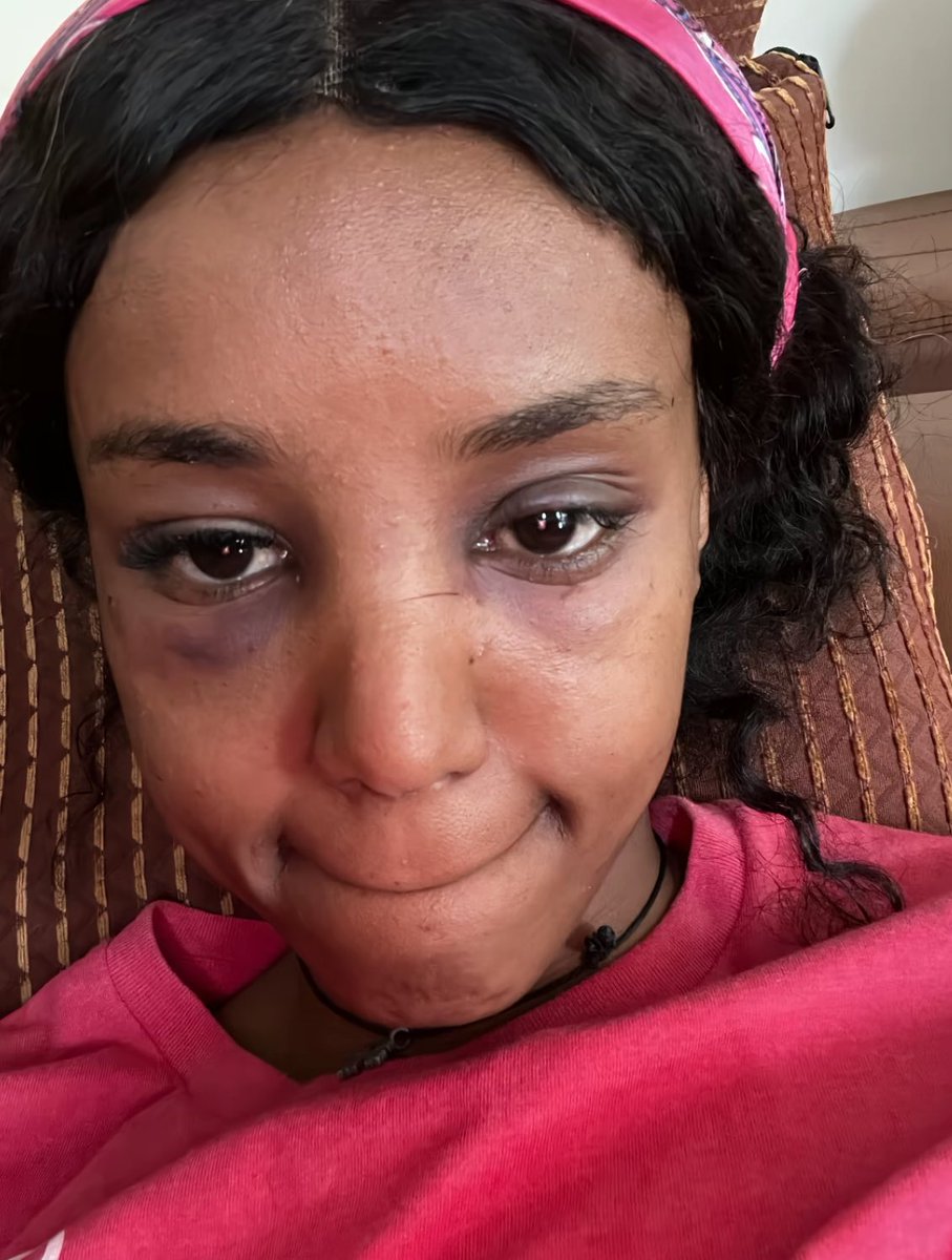 Your mother is a woman.Your sister is a woman. So why do you harm another woman?A woman does not need to b your mother or your sister to deserve respect.She’s someone’s daughter,  friend &amp; whole world.Stop domestic violence. Hold abusers accountable.
#JusticeForKanani ነግ በኔ💔