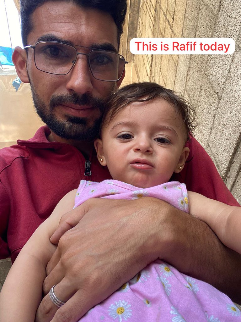 Look at how much Rafif has changed in just 33 days…
Her weight keeps dropping day by day.

Ignore my own thinness — I can endure it.
But how can a baby who hasn’t even turned one endure hunger?

She needs food to grow… to build her little body… to live.

All of this is because