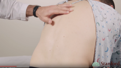 StanfordMed25's tweet image. Tip for the low back #PhysicalExam: Inspection is best done by first observing your patient first standing upright, then again bending forward while still standing. More tips --> stanford.io/2VAoTDP