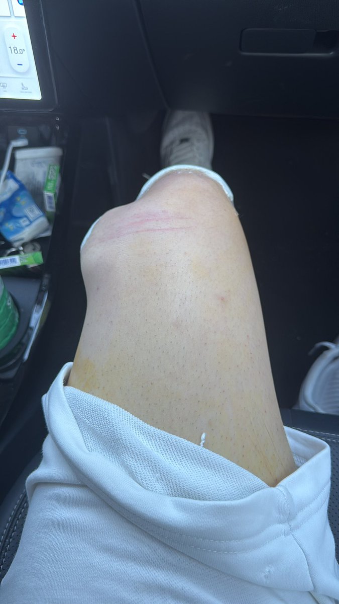 〽️athis. tweet media