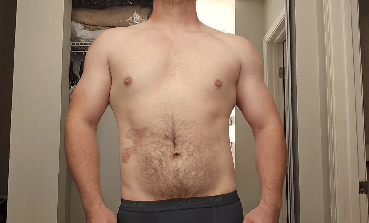 DrevoTheWolf's tweet photo. Progress update.
(It's cold) regardless, im down 20-25lbs, and I believe have made a lot of progress overall. Very happy with myself (from jan 2025 to today) https://t.co/po1LZ0RUWR