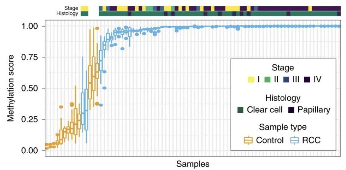 UroToday.com (@urotoday) on Twitter photo Interdisciplinary #GUCancerForum 2025: The role of ctDNA in monitoring patients with metastatic disease. Presented by <a href="/OncHahn/">Andy Hahn</a> <a href="/MDAndersonNews/">MD Anderson Cancer Center</a>. Written coverage by <a href="/zklaassen_md/">Zach Klaassen</a> <a href="/GACancerCenter/">Georgia Cancer Center</a> > bit.ly/44hgJ8l Interdisciplinary #GUCancerForum 2025: The role of ctDNA in monitoring patients with metastatic disease. Presented by <a href="/OncHahn/">Andy Hahn</a> <a href="/MDAndersonNews/">MD Anderson Cancer Center</a>. Written coverage by <a href="/zklaassen_md/">Zach Klaassen</a> <a href="/GACancerCenter/">Georgia Cancer Center</a> > bit.ly/44hgJ8l