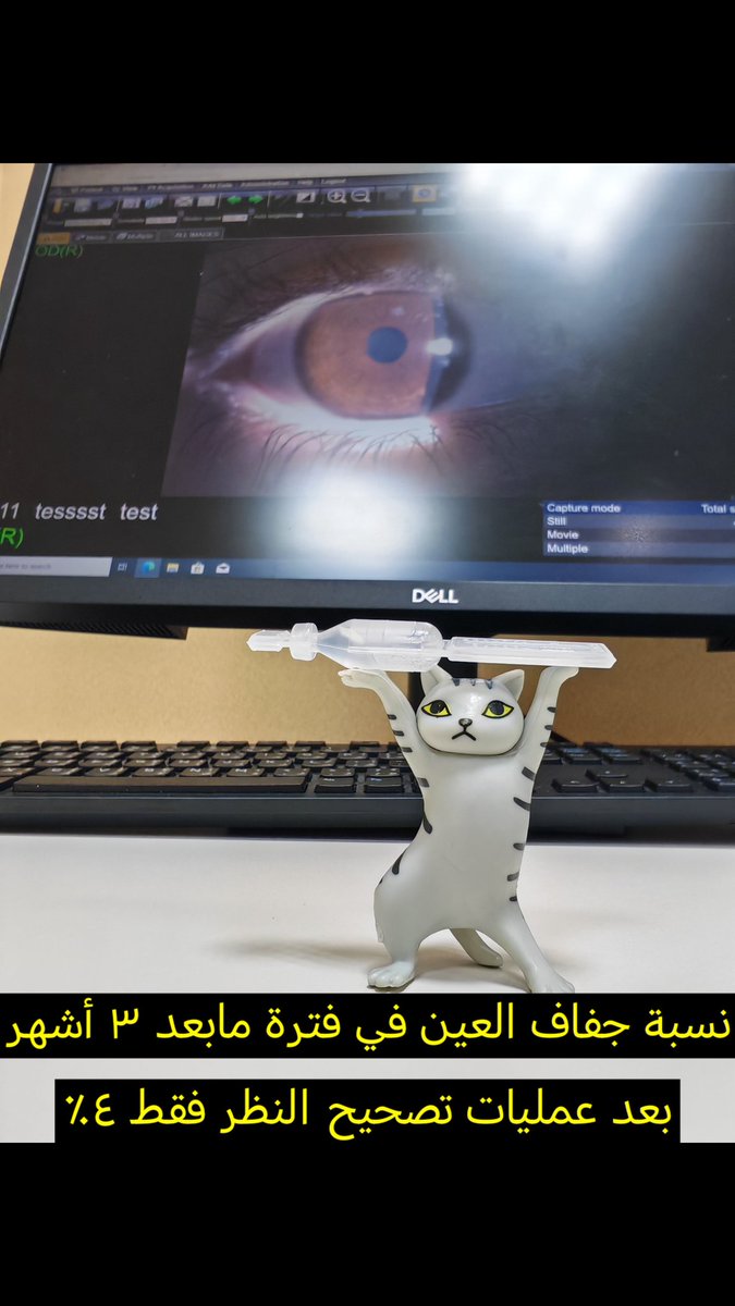 كم نسبة جفاف العين عند من أجرى عملية تصحيح النظر ؟

 الجواب في الصورة المرفقة

#تصحيح_نظر #تصحيح_النظر #ليزك #جفاف_العين #دكتور_عيون #جدة #حسين_مرفق