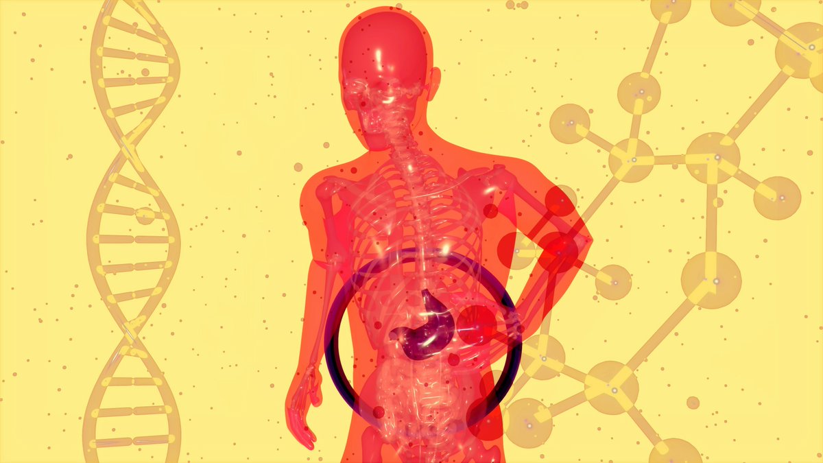 TheDailyRemedy's tweet photo. Feeding Remission: How Anti-Inflammatory Diets Are Quietly Boosting Colorectal-Cancer Survival
 #AntiInflammatoryDiet #CancerSurvivorship #ColorectalCancer #LowGI #ProteinQuality #Trends
https://t.co/7AEJ4d3y2C https://t.co/Ed6VYnktOF