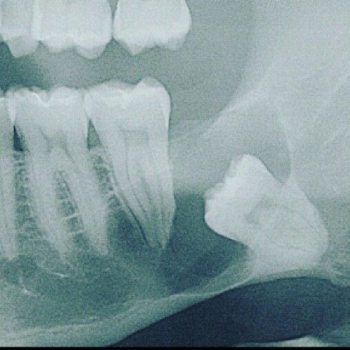 ☢️ Diagnosis and Treatment?