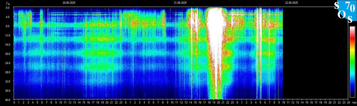 Schumann Rezonansı ve ABD İran Nükleer Tesislerini vurdu kurgusu ile kollektif bilinç ÖRÜNTÜSÜ
Önce Orta yoğunlukta rezonans
Olay anı Aşırı güçlü beyaz parlama
Sonrası Yüksek rezonans
Medyada duyulması, insanların aniden tepki(negatif) vermesi ile rezonans pikleri zamanı
KORKMA🤍