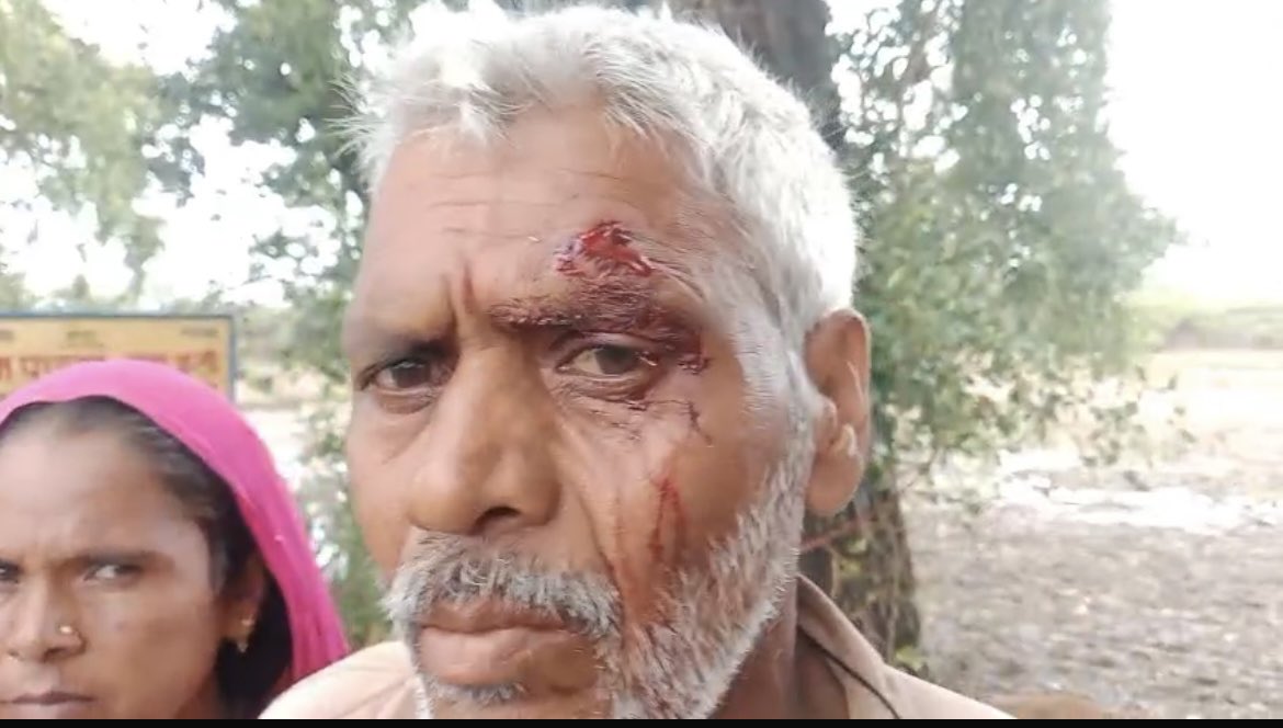 hrd9473's tweet photo. बांदा UPदबंगों का जानलेवा हमला
ग्राम नौगवां थाना कालिंजर में सुल्तानी,महरूम,समीना व ने साहबदीन पुत्र इमामी व शेर अली पुत्र साहबदीन को घर मे घुसकर बुरी तरह पीटा
साहबदीन व शेर अली के सिर पर गंभीर चोटें आईं
पीड़ित डरे हुए है,प्रशासन से न्याय की मांग
@bandapolice @igrangealld @dgpup https://t.co/j3sbs1H3pV