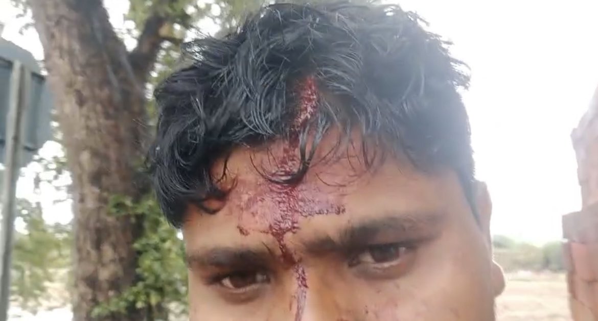 hrd9473's tweet photo. बांदा UPदबंगों का जानलेवा हमला
ग्राम नौगवां थाना कालिंजर में सुल्तानी,महरूम,समीना व ने साहबदीन पुत्र इमामी व शेर अली पुत्र साहबदीन को घर मे घुसकर बुरी तरह पीटा
साहबदीन व शेर अली के सिर पर गंभीर चोटें आईं
पीड़ित डरे हुए है,प्रशासन से न्याय की मांग
@bandapolice @igrangealld @dgpup https://t.co/j3sbs1H3pV