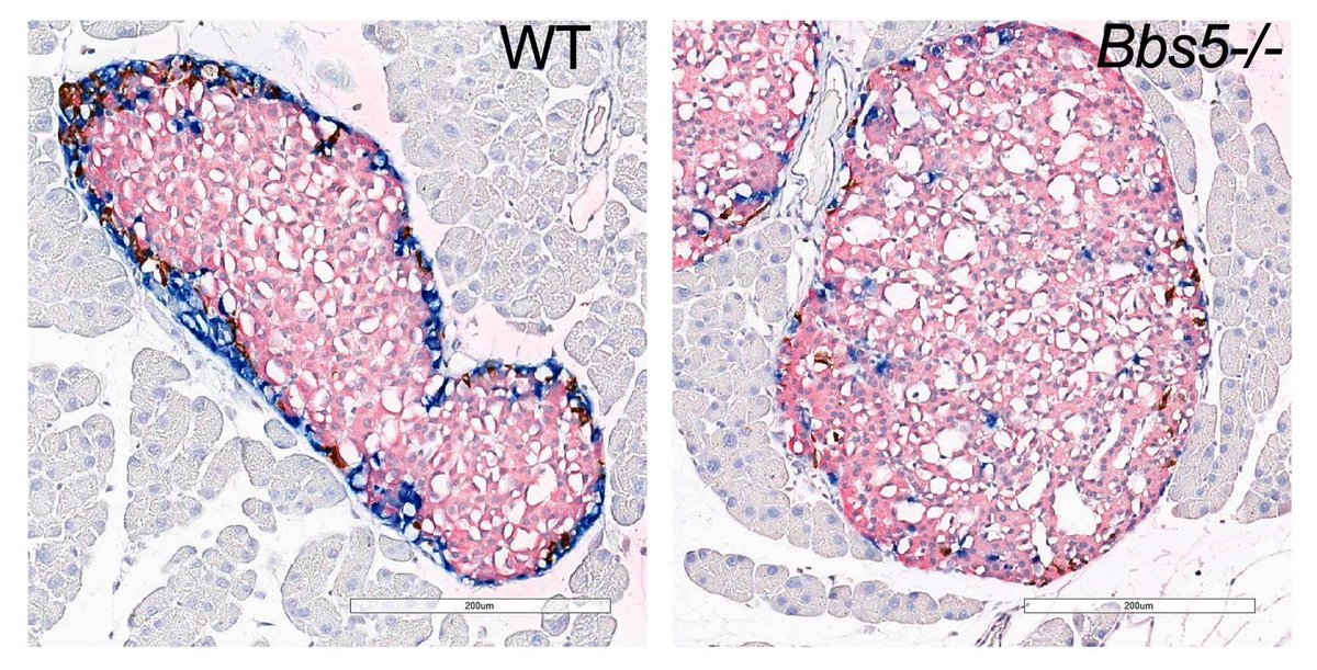 Journal of Clinical Investigation (@jclinicalinvest) on Twitter photo ICYMI:
Identifying GLP-1 receptor therapy as a first-in-class treatment for Bardet-Biedl syndrome—
@gdelartigue, <a href="/SinghArashdeep/">Arashdeep Singh🐁🧠🥙</a> & team <a href="/MonellSc/">Monell Center</a> show treatment with semaglutide reduced eating/weight gain, and improved glucose tolerance and cognitive behavior in a BBS mouse ICYMI:
Identifying GLP-1 receptor therapy as a first-in-class treatment for Bardet-Biedl syndrome—
@gdelartigue, <a href="/SinghArashdeep/">Arashdeep Singh🐁🧠🥙</a> & team <a href="/MonellSc/">Monell Center</a> show treatment with semaglutide reduced eating/weight gain, and improved glucose tolerance and cognitive behavior in a BBS mouse