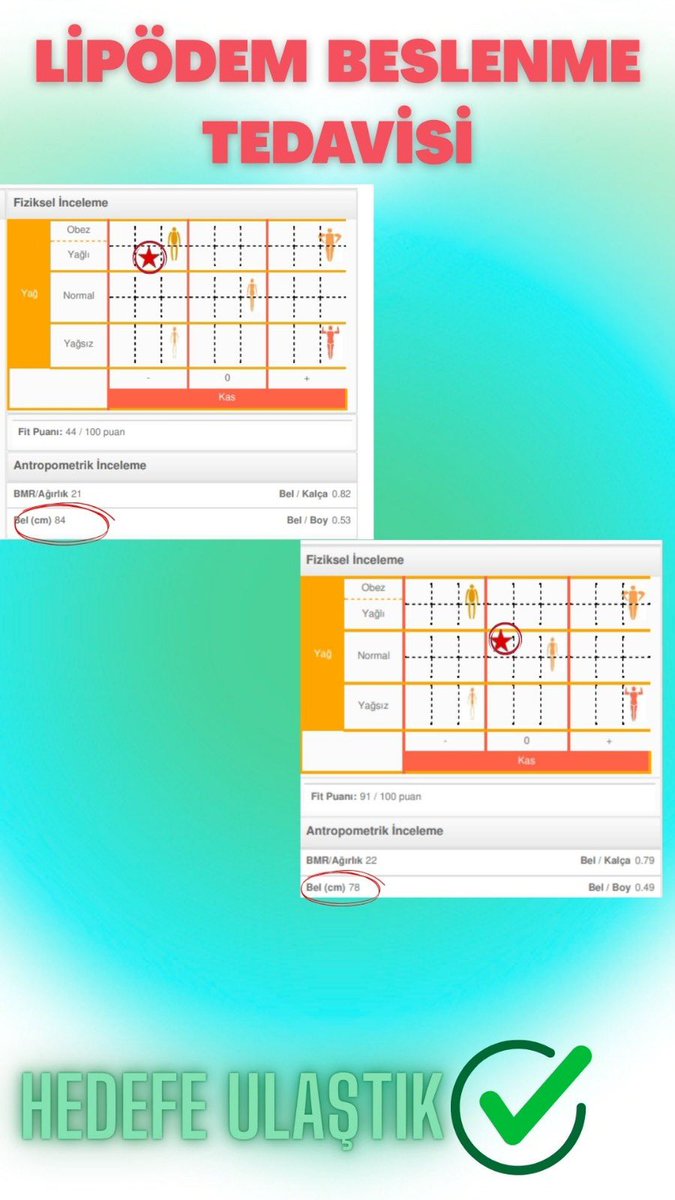 Pazar mesaisinden şahane tablolar
Aylık yüzyüze görüştüğüm online ilerlediğimiz danışanım ile incelmeler ve kas artışı sağladık hedefe ulaştık 🎯🎯 #lipödem