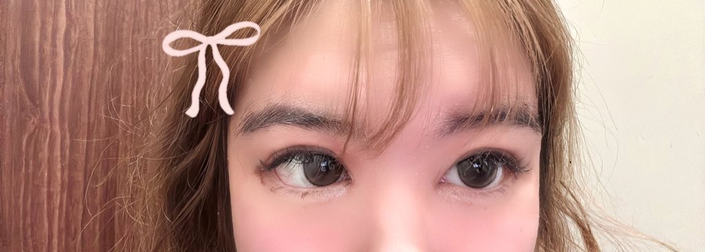 ccc98424's tweet photo. 最近埋没（自然癒着）と目頭切開と涙袋ヒアルロン酸やったー
ダーマペン契約してるけどまだやってやい https://t.co/49lIzJfLv8