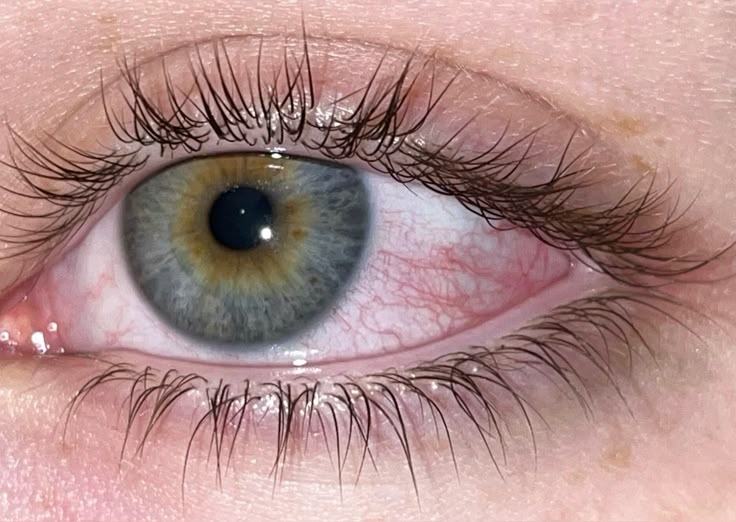 illbuyuawhiskey's tweet photo. Существование центральной гетерохромии ЗАМАЛЧИВАЕТСЯ
Население делят на глазные КАСТЫ заставляя тех, кто в них не вписывается, придумывать себе цвет глаз который к ним НЕ ОТНОСИТСЯ
Моя президентская программа: называть ц.гетерохромию лесным цветом и ставить его наравне с другими https://t.co/4TPClYetCm