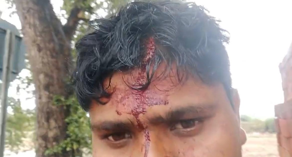 hrd9473's tweet photo. @bandapolice @igrangealld @dgpup @CMOfficeUP @PMOIndia @ABPNews @aajtak @BBCBreaking अभी तक दबंग आरोपी अरेस्ट नहीं हुए,जबकि उन्होंने 1200मीटर दूर आकर घर में घुसकर जानलेवा हमला किय,हत्या के प्रयास की गंभीर धाराएं होने के बावजूद सिर्फ दोनों पक्षों की तहरीर लेकर लीपापोती की जा रही है। कृपया तुरंत गिरफ्तारी कर निष्पक्ष कार्रवाई करें
@bandapolice @igrangealld @dgpup https://t.co/A1EsNg0ayx