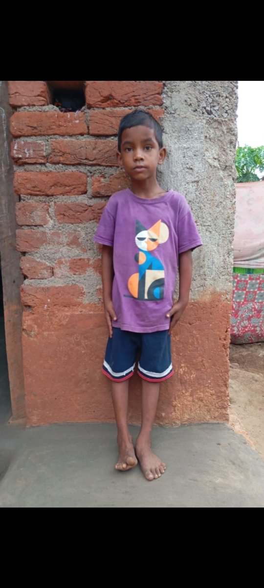MalikSurendraT's tweet photo. @PMOIndia @CMO_Odisha @SSEPD2 @CollectorBgr @MajhiGiriraj @BdoTurekela @BssoTurekela @TigSDM ଜିଲ୍ଲା #ବଲାଙ୍ଗୀର ବ୍ଲକ #ତୁରେକେଲା #ଦାବ୍ରୀ ଗ୍ରାମର #ବିହାନ ନାଗ ଏହି ପ୍ରର୍ଯ୍ୟନ୍ତ କୌଣସି ସରକାରୀ ସାହାଯ୍ୟ ପାଇନାହାନ୍ତି ତେଣୁକରି ଜିଲ୍ଲା ପ୍ରଶାସନ୍ ଧ୍ୟାନ ଦେବାଉଚିତ୍ । https://t.co/A6IldOCXN0