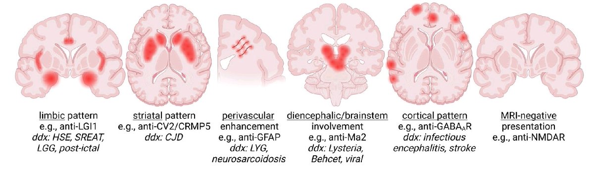 It is about pattern recognition...
🧠 Radiological patterns in autoimmune encephalitis...
doi.org/10.1007/s00234…
