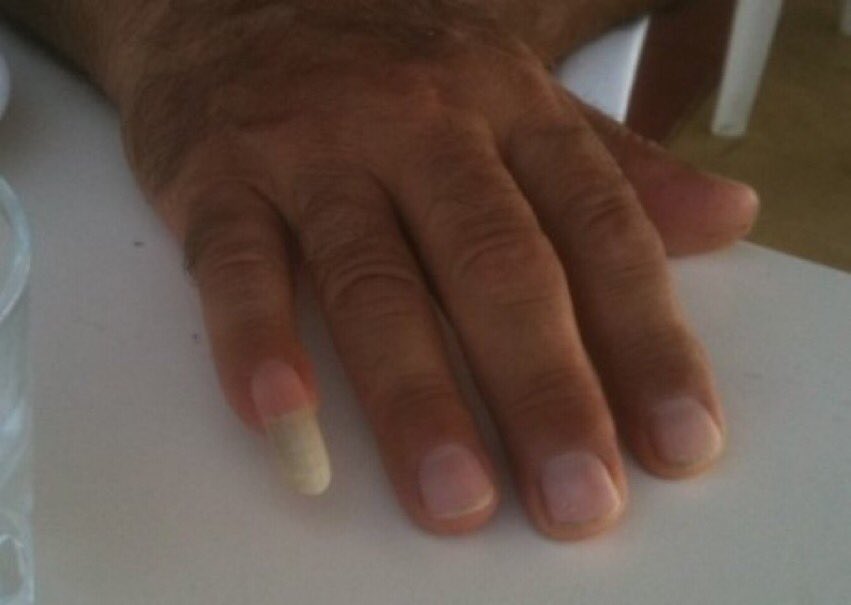 Samo da ne mu stapnat na žulj na Tramp. Edno dugme da stisne čičoto u vazduh go kreva cel Irak.