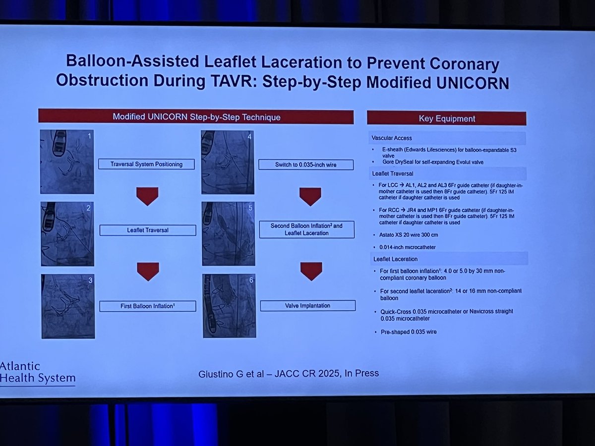 Poonam Velagapudi (@pooh_velagapudi) on Twitter photo Prevention of coronary obstruction in high risk VIV!! <a href="/CorsVascAtShore/">Cors/Vasc at the Shore</a> <a href="/CorsAtTheShore/">CorsAtTheShore</a> <a href="/CardiacConsult/">Jordan Safirstein MD</a> <a href="/rzakir12/">Ramzan Zakir</a> #ACCEarlyCareer #ACCFIT #ACCEarlyCareer <a href="/SCAI/">SCAI</a> <a href="/scaiwin/">SCAIWIN</a> Prevention of coronary obstruction in high risk VIV!! <a href="/CorsVascAtShore/">Cors/Vasc at the Shore</a> <a href="/CorsAtTheShore/">CorsAtTheShore</a> <a href="/CardiacConsult/">Jordan Safirstein MD</a> <a href="/rzakir12/">Ramzan Zakir</a> #ACCEarlyCareer #ACCFIT #ACCEarlyCareer <a href="/SCAI/">SCAI</a> <a href="/scaiwin/">SCAIWIN</a>