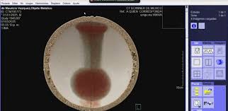 UAPWatchers's tweet image. 📸Scan and X-ray Images From The Buga Sphere
#Bugasphere